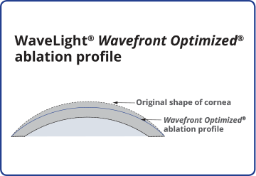 wavelight ex500