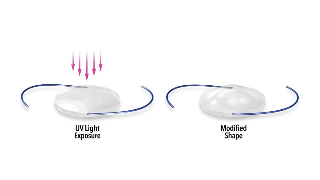 LAL- modified shape